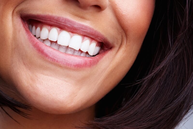 Cosmetic Dentist Novato