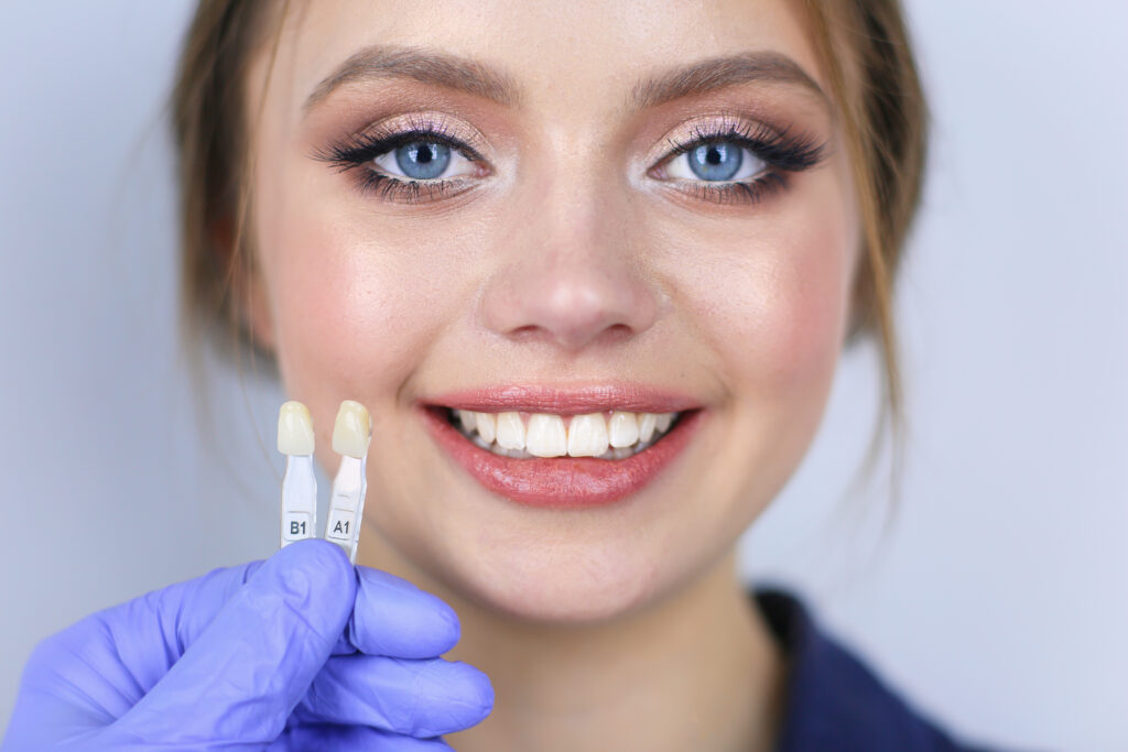 Dental Veneers in Novato